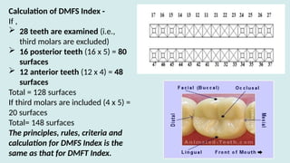 Comprehensive Overview of Dental Indices: Caries, Fluorosis, and ...