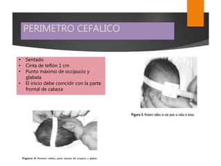 PERIMETRO CEFALICO
• Sentado
• Cinta de teflón 1 cm
• Punto máximo de occipucio y
glabela
• El inicio debe coincidir con la parte
frontal de cabeza
 