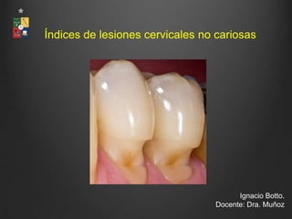 Índices de lesiones cervicales no cariosas




                                       Ignacio Botto.
                                 Docente: Dra. Muñoz
 