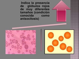 Indica la presencia
de glóbulos rojos
de muy diferentes
tamaños (condición
conocida como
anisocitosis)
 