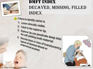 Indices for dental caries | PPTX