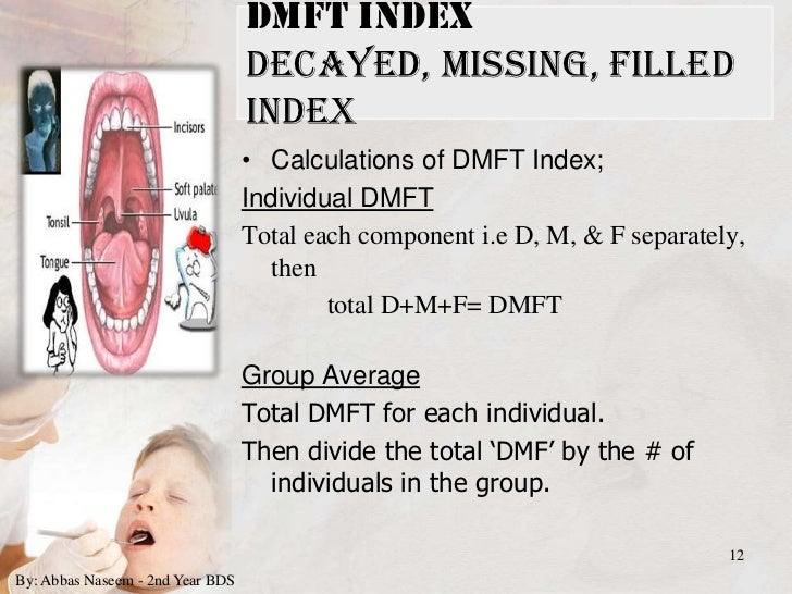 indices for dental caries charting dental restorations