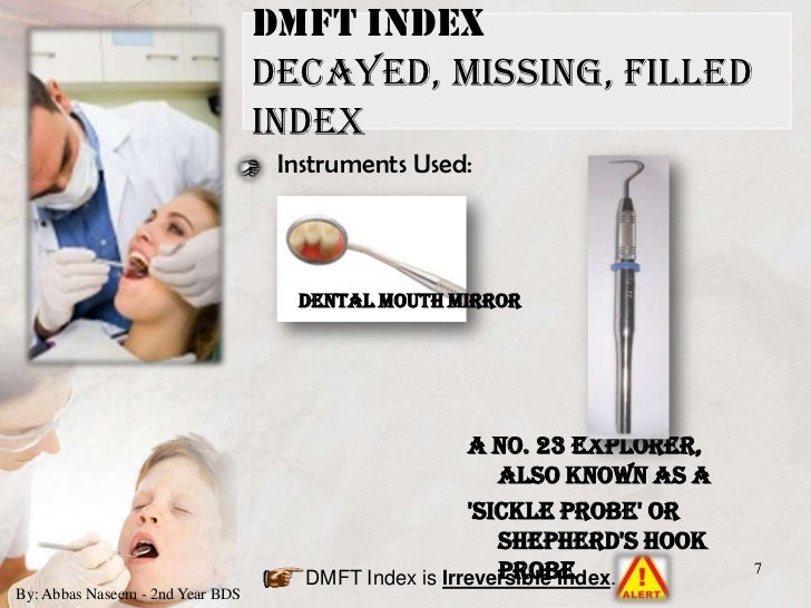 Indices for dental caries