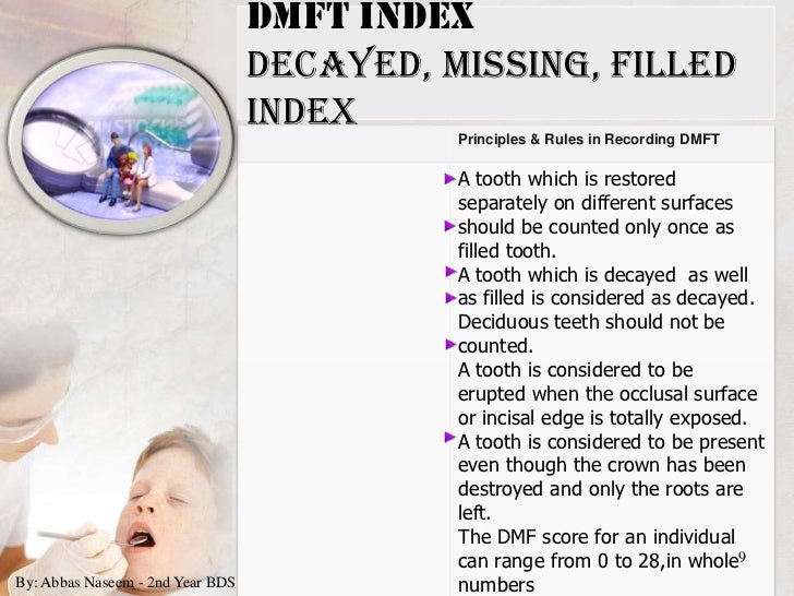 Indices for dental caries