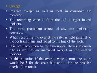 Indices in orthodontics | PPTX