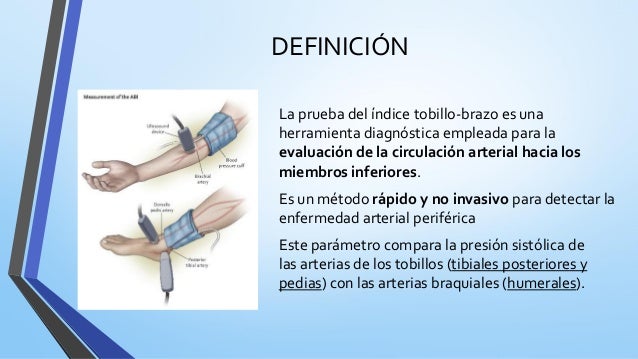 Indice tobillo brazo