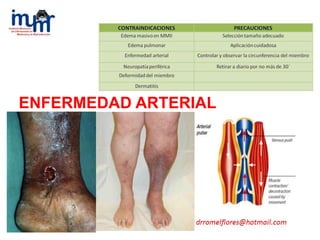 ENFERMEDAD ARTERIAL
 