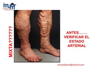 MIXTA??????
ANTES…….
VERIFICAR EL
ESTADO
ARTERIAL
 