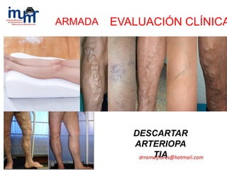 ARMADA
DESCARTAR
ARTERIOPA
TIA
EVALUACIÓN CLÍNICA
 