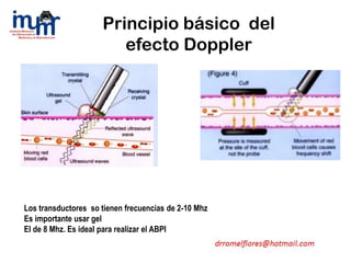 Los transductores so tienen frecuencias de 2-10 Mhz
Es importante usar gel
El de 8 Mhz. Es ideal para realizar el ABPI
Principio básico del
efecto Doppler
 