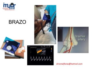 BRAZO
 