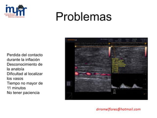 Perdida del contacto
durante la inflación
Desconocimiento de
la anatoía
Dificultad al localizar
los vasos
Tiempo no mayor de
11 minutos
No tener paciencia
Problemas
 