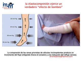La compresión de las venas provistas de válvulas incompetentes produce un
incremento del flujo ortógrado (hacia el corazón) y una reducción del reflujo venoso.
la elastocompresión ejerce un
verdadero “efecto de bombeo”
 