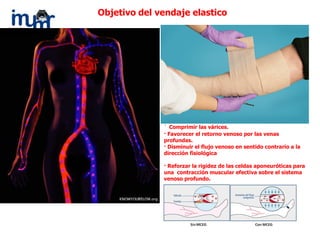 · Comprimir las várices.
· Favorecer el retorno venoso por las venas
profundas.
· Disminuir el flujo venoso en sentido contrario a la
dirección fisiológica
· Reforzar la rigidez de las celdas aponeuróticas para
una contracción muscular efectiva sobre el sistema
venoso profundo.
Objetivo del vendaje elastico
 