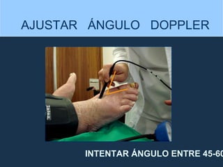 AJUSTAR  ÁNGULO  DOPPLER INTENTAR ÁNGULO ENTRE 45-60º 