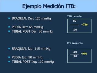 BRAQUIAL Der: 120 mmHg PEDIA Der: 65 mmHg TIBIAL POST Der: 80 mmHg BRAQUIAL Izq: 115 mmHg PEDIA Izq: 90 mmHg TIBIAL POST Izq: 110 mmHg Ejemplo Medición ITB: ITB derecho 80 120 ITB izquierdo 110 120 = 0’66 = 0’91 