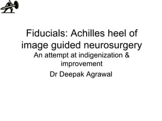 Fiducials: Achilles heel of image guided neurosurgery An attempt at indigenization & improvement Dr Deepak Agrawal 