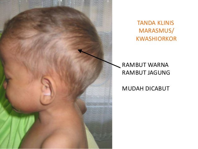 Indikator Gizi Yusni Indikator Gizi Yusni