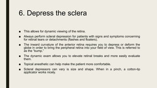 6. Depress the sclera
■ This allows for dynamic viewing of the retina.
■ Always perform scleral depression for patients with signs and symptoms concerning
for retinal tears or detachments (flashes and floaters).
■ The inward curvature of the anterior retina requires you to depress or deform the
globe in order to bring the peripheral retina into your field of view. This is referred to
as the “bump.”
■ The dynamic exam allows you to elevate retinal breaks and more easily evaluate
them.
■ Topical anesthetic can help make the patient more comfortable.
■ Scleral depressors can vary is size and shape. When in a pinch, a cotton-tip
applicator works nicely.
 