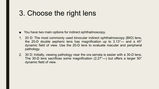3. Choose the right lens
■ You have two main options for indirect ophthalmoscopy.
1. 20 D: The most commonly used binocular indirect ophthalmoscopy (BIO) lens,
the 20-D double aspheric lens has magnification up to 3.13°— and a 45°
dynamic field of view. Use the 20-D lens to evaluate macular and peripheral
pathology.
2. 30 D: Initially, viewing pathology near the ora serrata is easier with a 30-D lens.
The 30-D lens sacrifices some magnification (2.27°—) but offers a larger 50°
dynamic field of view.
 