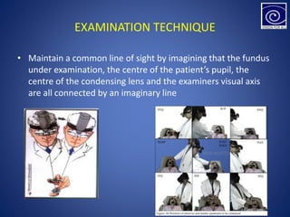 EXAMINATION TECHNIQUE
• Maintain a common line of sight by imagining that the fundus
under examination, the centre of the patient’s pupil, the
centre of the condensing lens and the examiners visual axis
are all connected by an imaginary line
 
