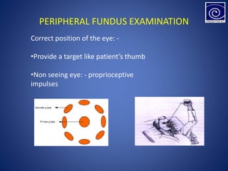 PERIPHERAL FUNDUS EXAMINATION
Correct position of the eye: -
•Provide a target like patient’s thumb
•Non seeing eye: - proprioceptive
impulses
 