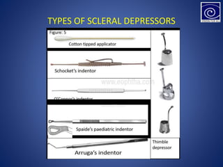 TYPES OF SCLERAL DEPRESSORS
 