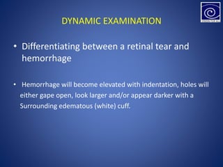 DYNAMIC EXAMINATION
• Differentiating between a retinal tear and
hemorrhage
• Hemorrhage will become elevated with indentation, holes will
either gape open, look larger and/or appear darker with a
Surrounding edematous (white) cuff.
 