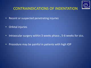CONTRAINDICATIONS OF INDENTATION
• Recent or suspected penetrating injuries
• Orbital injuries
• Intraocular surgery within 3 weeks phaco , 5-6 weeks for sics.
• Procedure may be painful in patients with high IOP
 