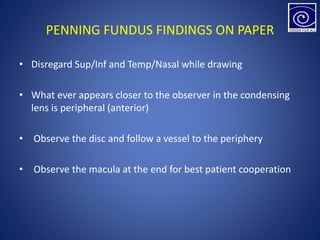PENNING FUNDUS FINDINGS ON PAPER
• Disregard Sup/Inf and Temp/Nasal while drawing
• What ever appears closer to the observer in the condensing
lens is peripheral (anterior)
• Observe the disc and follow a vessel to the periphery
• Observe the macula at the end for best patient cooperation
 
