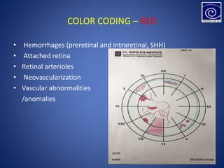 COLOR CODING – RED
• Hemorrhages (preretinal and intraretinal, SHH)
• Attached retina
• Retinal arterioles
• Neovascularization
• Vascular abnormalities
/anomalies
 