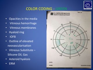 COLOR CODING - GREEN
• Opacities in the media
• Vitreous hemorrhage
• Vitreous membranes
• Hyaloid ring
• IOFB
• Outline of elevated
neovascularisation
• Vitreous Substitute –
Silicone Oil, Gas
• Asteroid hyalosis
• ERM
 