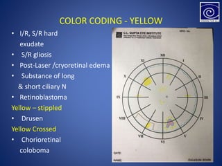 COLOR CODING - YELLOW
• I/R, S/R hard
exudate
• S/R gliosis
• Post-Laser /cryoretinal edema
• Substance of long
& short ciliary N
• Retinoblastoma
Yellow – stippled
• Drusen
Yellow Crossed
• Chorioretinal
coloboma
 