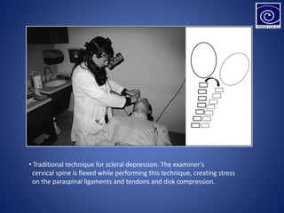 • Traditional technique for scleral depression. The examiner’s
cervical spine is flexed while performing this technique, creating stress
on the paraspinal ligaments and tendons and disk compression.
 