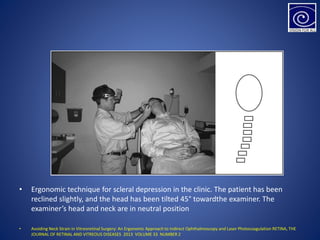 • Ergonomic technique for scleral depression in the clinic. The patient has been
reclined slightly, and the head has been tilted 45° towardthe examiner. The
examiner’s head and neck are in neutral position
• Avoiding Neck Strain in Vitreoretinal Surgery: An Ergonomic Approach to Indirect Ophthalmoscopy and Laser Photocoagulation RETINA, THE
JOURNAL OF RETINAL AND VITREOUS DISEASES 2013 VOLUME 33 NUMBER 2
 