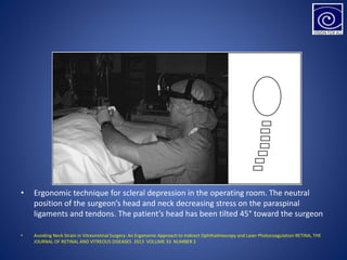 • Ergonomic technique for scleral depression in the operating room. The neutral
position of the surgeon’s head and neck decreasing stress on the paraspinal
ligaments and tendons. The patient’s head has been tilted 45° toward the surgeon
• Avoiding Neck Strain in Vitreoretinal Surgery: An Ergonomic Approach to Indirect Ophthalmoscopy and Laser Photocoagulation RETINA, THE
JOURNAL OF RETINAL AND VITREOUS DISEASES 2013 VOLUME 33 NUMBER 2
 