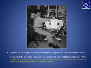• Ergonomic technique for indirect laser photocoagulation. The technique can also
be used in the neonatal intensive care unit during laser photocoagulation of ROP.
• Avoiding Neck Strain in Vitreoretinal Surgery: An Ergonomic Approach to Indirect Ophthalmoscopy and Laser Photocoagulation RETINA, THE
JOURNAL OF RETINAL AND VITREOUS DISEASES 2013 VOLUME 33 NUMBER 2
 
