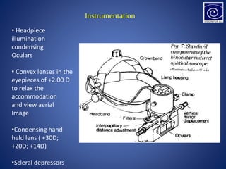 Instrumentation
• Headpiece
illumination
condensing
Oculars
• Convex lenses in the
eyepieces of +2.00 D
to relax the
accommodation
and view aerial
Image
•Condensing hand
held lens ( +30D;
+20D; +14D)
•Scleral depressors
 