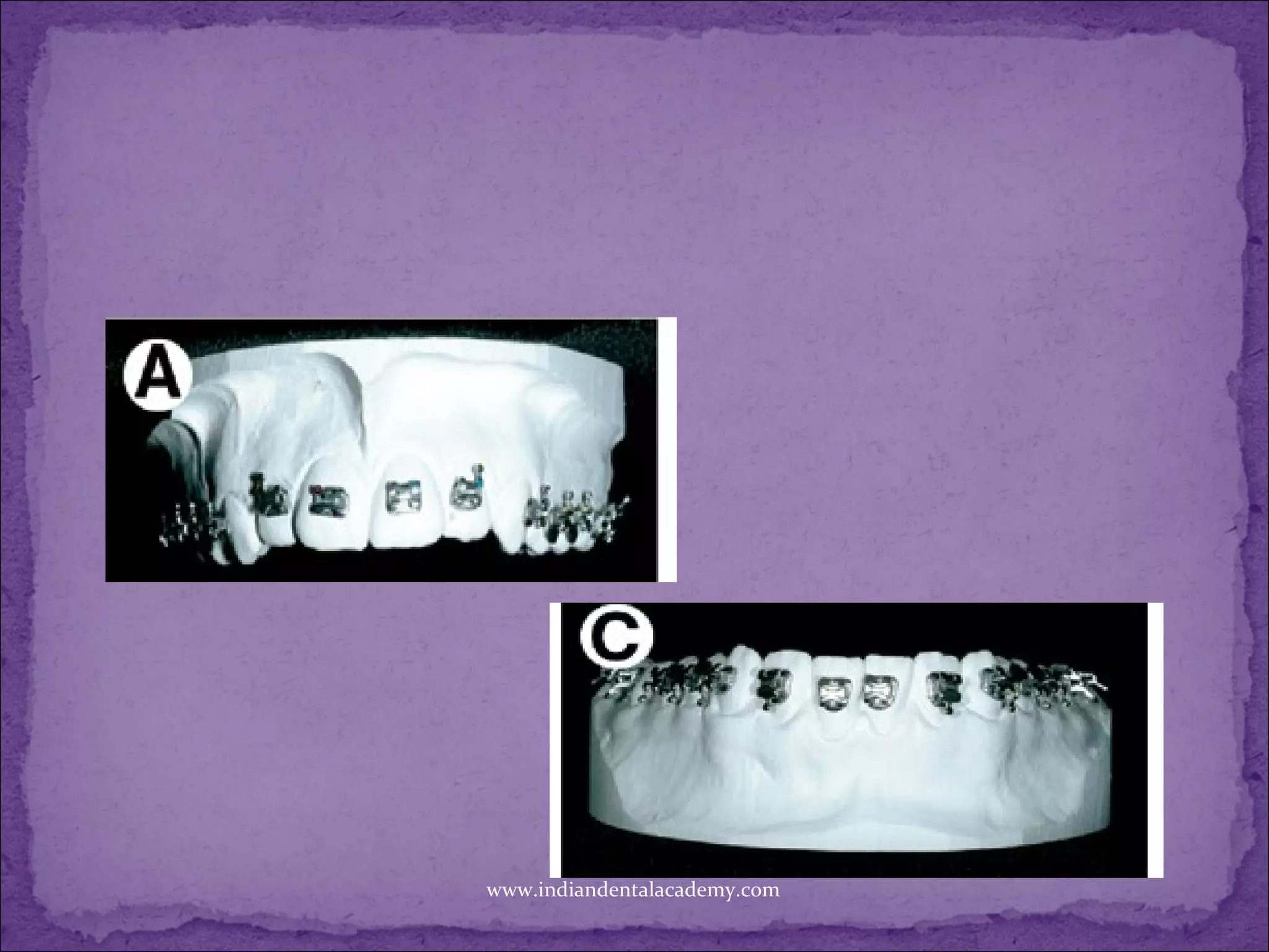 www.indiandentalacademy.com
 
