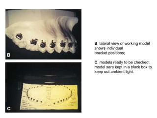 B, lateral view of working model
shows individual
bracket positions;
C, models ready to be checked;
model sare kept in a black box to
keep out ambient light.
 