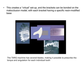 The TARG machine has several blades, making it possible to prescribe the
torque and angulation for each individual tooth
• This creates a “virtual” set-up, and the brackets can be bonded on the
malocclusion model, with each bracket having a specific resin-modified
base
 