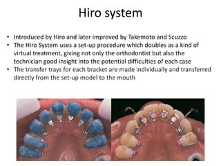 Hiro system
• Introduced by Hiro and later improved by Takemoto and Scuzzo
• The Hiro System uses a set-up procedure which doubles as a kind of
virtual treatment, giving not only the orthodontist but also the
technician good insight into the potential difficulties of each case
• The transfer trays for each bracket are made individually and transferred
directly from the set-up model to the mouth
 