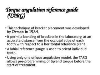 Indirect bonding in lingual orthodontics parag | PPTX
