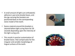 Indirect bonding in lingual orthodontics parag | PPTX