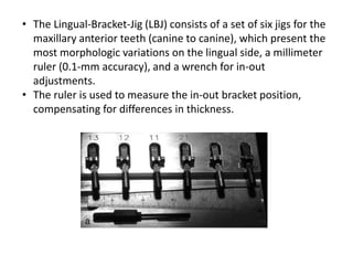 Compensating Ruler Indirect bonding in lingual orthodontics parag | PPTX
