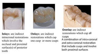 Comprehensive Guide to Indirect Esthetic Dental Restorations and ...