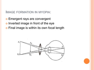 Indirect ophthalmoscopy | PPT