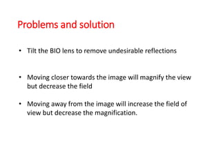 • Tilt the BIO lens to remove undesirable reflections
• Moving closer towards the image will magnify the view
but decrease the field
• Moving away from the image will increase the field of
view but decrease the magnification.
Problems and solution
 