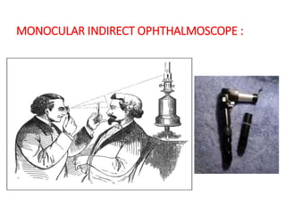MONOCULAR INDIRECT OPHTHALMOSCOPE :
 