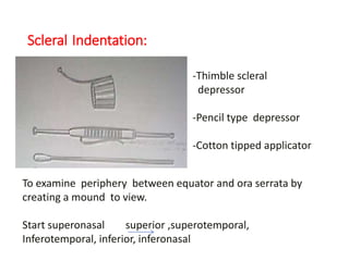 Scleral Indentation:
-Thimble scleral
depressor
-Pencil type depressor
-Cotton tipped applicator
To examine periphery between equator and ora serrata by
creating a mound to view.
Start superonasal superior ,superotemporal,
Inferotemporal, inferior, inferonasal
 